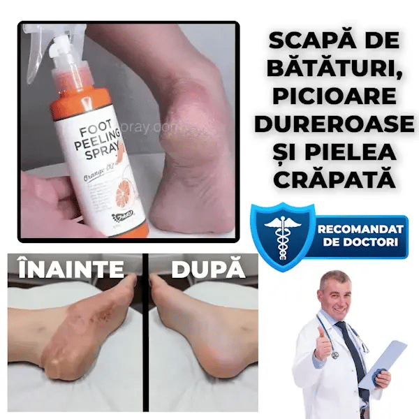 SPRAY EXFOLIANT FreshFeet™